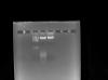 REU Experiment in Progress